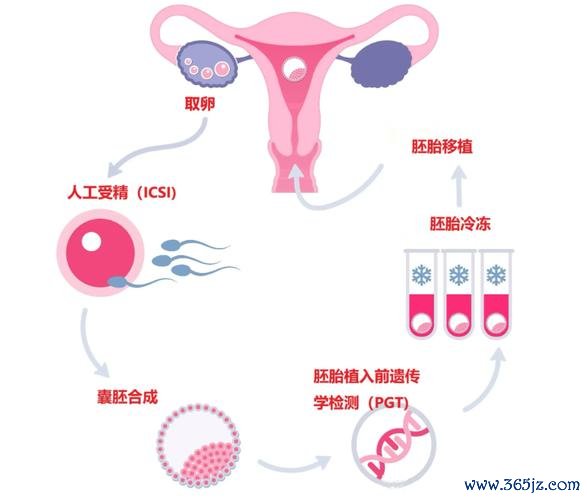 不孕不育解决方案试管婴儿技术助力生育